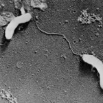 『豚コレラ』国内26年ぶり感染確認 豚などがかかる致死率高く治療方法ない伝染病 岐阜