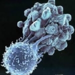がん細胞を攻撃する「キラーT細胞」　働きが悪くなる仕組みを解明