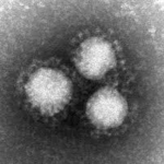 北九州市で２例目の新型コロナウイルス患者確認